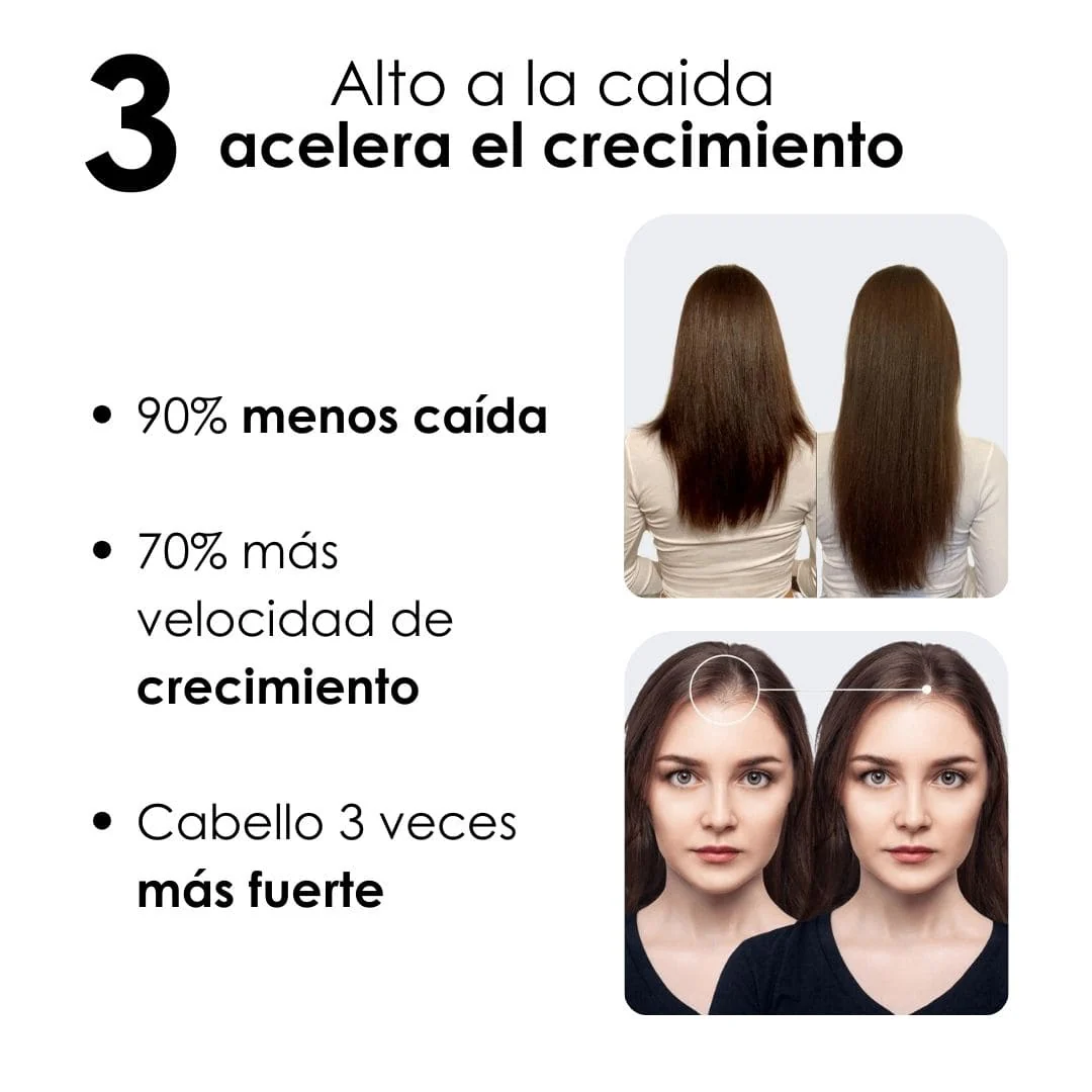 Kit Crecimiento + Anticaída + Reparación + Protección 250 ML - Image 5